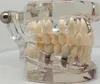 Andra orala hygien tänder Neural reparation Dental Implantat Patologiska modell tandläkare Studenter Kommunikation Lärande forskningssjukdom undervisning 230417