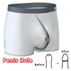 Cuecas homem separado dupla bolsa roupa interior phimose respiração longo prepúcio fisioterapia lingerie frente aberta buraco bainha boxers melhorar