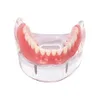 Andra orala hygienens tandimplantatåterställningständer Modell Borttagbar bridge Denture Demo Disease Teeth Model With Restoration Bridge Teaching Study 230425