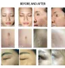 NOUVELLE machine laser Co2 fractionnaire Serrer les soins de la peau du vagin Rajeunissement de la peau Cicatrice indolore Enlever les vergetures Traitement Traitement de l'équipement de salon de beauté