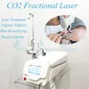 Fractionele CO2 lasermachine acne litteken behandeling striae striae verwijdering vaginale aanscherping laser huid opnieuw opduiken