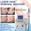 Máquina a laser ipl depilação maquina opt depilador efeito rápido tratamento indolor laser ce aprovado um ano de garantia