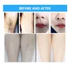 beauty items 2 in1permanent hair removal picosecond tattoo removal carbon peeling diode laser hair removal machine appliances