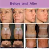 Andere Schönheitsausrüstung 6D HIFU Vaginalverjüngung HIFU Facelifting-Maschine HIFU-System 2 Griffe 10 Kartuschen