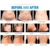 Best uitgeruste gebruikershandleiding LLLT Lipo-lasersysteem 14 pads Laserlipolyse Zerona Cellulitisverwijdering Afslanken Zerona-machine te koop