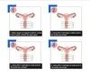Annan skönhetsutrustning HIFU Vaginal föryngringsmaskiner rynka borttagningsmaskin till salu
