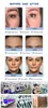 Multifunktions-Radiofrequenzgeräte für Kosmetikerinnen Hautpflege-Tools Sauerstoff-Gesichtsmaschine zu verkaufen Facial Swan Steamer