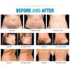 Compre Lipo Laser 650Nm Lllt 14 Pads Laser Body Slimming Máquina de remoção de celulite Ganhe presente grátis