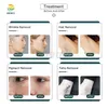 Laser 5 in 1 ce approved elight pigmentation removal ipl hair removal machine