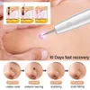 Ansiktsvårdsanordningar Skin Tag Remover Laser Plasma Pen Dark Spot Mole Wart Remover Pen Electric Tattoo Freckle Nevus Black Spots Skin Tag Removal 230217