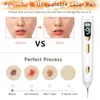 Face Care Devices Electric Plasma Mole Removal Pen Laser Set Wart Remover Skin Pore Care Corn Freckle Dark Tag Nevus Pimple Spot Tattoo Cleaner 230217