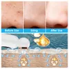 Scrubbers Blackhead Remover Vacuum Suction Small Bubble Pore Cleaser Device0 Pimple Extractor Microdermabrasion Electric Blackhead Cleaner