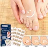 Zorg 50 stks/doos Nagel Correctie Sticker Pedicure Voet Teen Nagel Ingegroeide Teennagel Correctie Tool Nagel Behandeling Elastische Patch Sticker