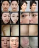 Hot 2023 بيع RF Microneedling Acne Scen Scar Removal RF Microneedle Radiofrecency Confering Home Beauty Salon