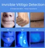 スキンアナライザーマシン用スチーマーウッズランプ紫外線UV試験ビューティーテスト拡大分析vitiligo 230609