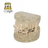 Andra munhygienens tandmodell med hängslen tandvårdsmaterial Ortodontiska modeller gummitandtänder för att studera undervisningspatientutbildning 230609
