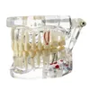 Autre Hygiène Bucco-Dentaire Modèle Dentaire Dents Implant Restauration Pont Enseignement Étude Science Maladie Dentiste Produits De Dentisterie Cadeau Dentaire 230609