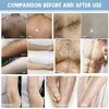 808nm Laser -Epilator Haarausfall Hautregeneration Maschine 2 Handles Diodenlaserhaut Aufweihung Körperdepilation Beauty Instrument