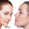 Massageador Facial LED Máscara de Beleza Remoção de Rugas Dispositivo Elétrico PDT Pon Tratamento SPA Aperte a pele Anti-idade Máquina de Acne 230612