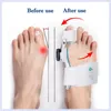 Foot Rasps Bunion Splint Big Toe Straightener Corrector Feet Pain Relief Hallux Valgus Correction Orthopedic Supplies Pedicure Care 230615