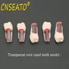 Autre hygiène bucco-dentaire 10Pc modèle de dent dentaire endodontique bloc de canal radiculaire RCT pratique pulpe cavité dentisterie remplacer résine dents Endo formation étudiant 230617