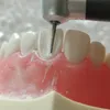 Andere Mundhygiene Dental Simulation Kopfmodell Zahnheilkunde Zahnmodell Phantomzahnheilkunde Eendodontie Harzzähne Lehrzubehör Weiches Zahnfleisch 230617