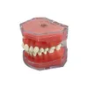 Autre modèle dentaire d'hygiène bucco-dentaire Modèle de dents amovibles Implant détachable Modèle de dent de gomme molle Dentiste Enseignement Recherche Dentisterie TYPODONT Modèle 230617