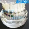 Autre hygiène bucco-dentaire 1 pièce modèle de dents de soins bucco-dentaires modèle orthodontique dentaire pour la Communication du patient modèle d'étude de dentiste 230617