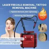 NIEUWE Q-switch ND YAG laser laser tatttoo verwijdering machine 755 1320 1064 532nm pigment sproet remover