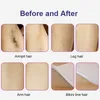 High Efficiency 2 in 1 Hair Tattoo Remove E-light Skin Rejuvenation OPT Elight IPL Device Hair Removal Laser ND Yag Tattoo Removal Machine