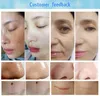 Spa Microdermabrazyon Cilt Temizleme Cilt Sıkılaştırıcı Makinesi Elmas Dermabrazyon Siyah Kırığı Sökme RF EM Cilt Bakım Güzellik Ekipmanları 8 Tutamaklı