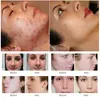 8 en 1 photodynamique + Dermabrasion dispositif anti-âge de beauté de la peau restauration de l'élasticité de la peau ultrasons Bio dragage lymphatique équipement bactéricide