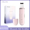 Urządzenia do pielęgnacji twarzy Ultrasonic Skin Scrubber LimpieZA PORE CZYTALA EMS Podnoszenie zaskórnika usuwanie ultradźwiękowej twarzy Ultrassonico 231012