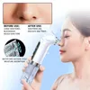 Face Care Devices Blackhead Remover Ultrasonic Skin Scrubber Vibration Face Spatula Scrubber Shovel Clean Cavitation Peeling Clove Removers 231012