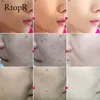 RtopR Facial Exfoliërende Gel Gezichtsreinigingscrème Gezichtsscrub Mee-eter Vet Vuil Olie Controle Reparaties Evens Tone Porie Draaien