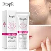 Rtopr ansiktsexfolierande gel ansikts ren grädde ansiktsskrubba blackhead fett smuts oljekontroll reparationer evens tone por strama