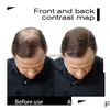 Hair Loss Products Natural Keratin Top Fiber 27.5G Black Build Thinning Concealer Styling Powder Er Bald Area Drop Delivery Care Tools Dh7Bg