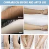 Large Power Laser Hair Removal Rejuvenation Skin Machine Permanent Epilator 808nm Diode Beauty Equipment