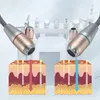 Multifunktionale Schönheitsausrüstung, 12-in-1-Instrument, kleines Blasenreinigungsinstrument, Haushalts-Mitesser-Maschine, Salon, spezielle Wasser-Lichtnadel