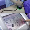 Autre équipement de beauté à double fréquence Machine de liposuccion à ultrasons 40k 80k Aspirateur de cavitation 25k Ensemble de liposuccion faciale 7 en 1 Dispositif de resserrement de la peau