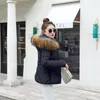 Frauen Trench Coats Frauen Winterjacke Parka abnehmbarer Pelzkragenmantel Frauen Frau Frau