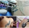 Alta qualidade 755nm q interruptor nd yag laser tatuagem Máquina de remoção de tatuagem picolaser remoção de pigmentos de pigmentos Instrumento de clareamento da pele