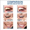 Dientes blanqueamiento esencia removedor de manchas de dientes para blanquear con efectivo sin sensibilidad viajar amigable f￡cil de usar hermosa sonrisa blanca