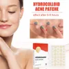 Dispositivos de cuidados com o rosto 144pcsset homens mulheres acne pimple patch 2 tamanhos invisíveis cura profissional absorvente adesivo de ponto cobrindo 221201
