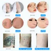 Hochintensiver Nd Yag Q-Switched Laser Pikosekunden-Maschine Tattooentfernung Hautverjüngungsgerät Hautpflege Pico Second Beauty Salon Verwendung