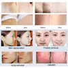 DPL Hair Removal Laser Machine Dye Pulse Light Elight IPL RF Skin Rejuvenation Beauty System