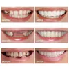 Andere Mundhygiene-Silikon-Ober- und Unterkiefer-Prothesen, Kosmetik, perfektes Lachen, Veneers, Zahnersatz, Paste, Werkzeuge, gefälschtes sofortiges Lächeln, 221114