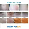 Tillbehör delar Mikronålskruvkassettbyte för penna derma mikro-needling 12 stift / 36 nano tatuering nålar