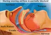 Snarkning CESSATION 15 st anti -enhet Nasal dilatorer Mask Snore Nos Clip Relieve Stop Sleep Aid för män Kvinnor 221121