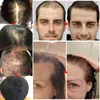 Crescimento do cabelo gengibre Óleo essencial Produtos anti -perda de cabelo Natural Crescer rápido Evite tratamento de calvície homens líquidos germinativos homens homens